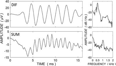 Characterizing Electrocochleography in Cochlear Implant Recipients with Residual Low-Frequency Hearing
